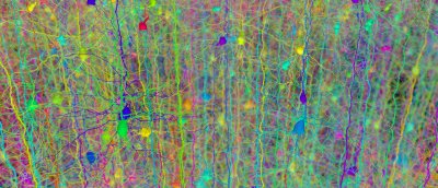 Visualisation eines neuronalen Netzewerks