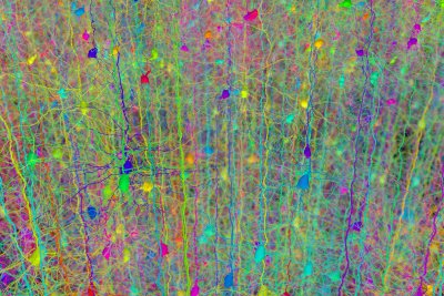 Visualisation eines neuronalen Netzewerks